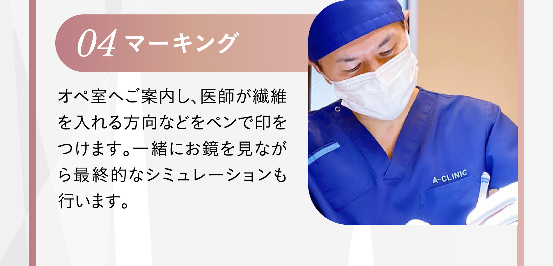 04 表面麻酔 施術のお痛みを抑えるため、お顔の表面に麻酔クリームを塗布致します。別途3,000円（税込3,300円）※痛みの感じ方には個人差があります。