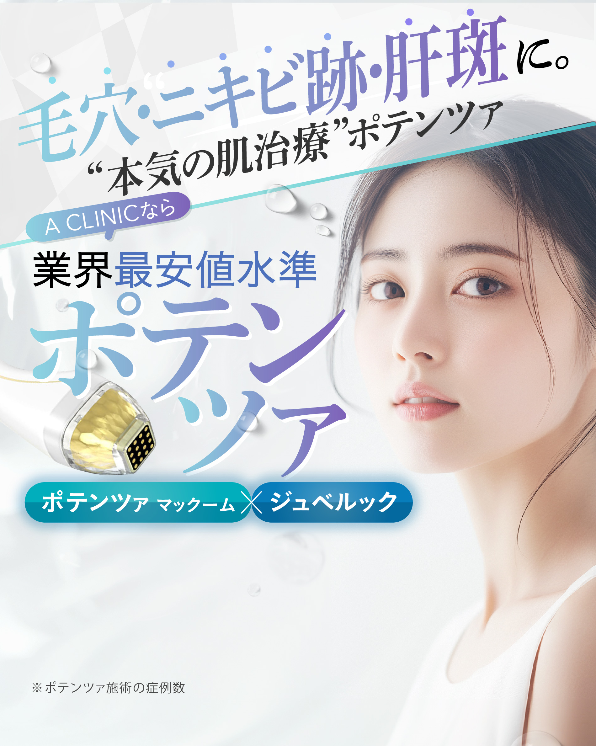 毛穴・ニキビ跡・肝斑に。“本気の肌治療”ポテンツァ A CLINICなら業界最安値水準 ポテンツァ ポテンツァ マックーム x ジュベルック