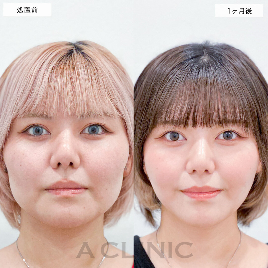 症例写真