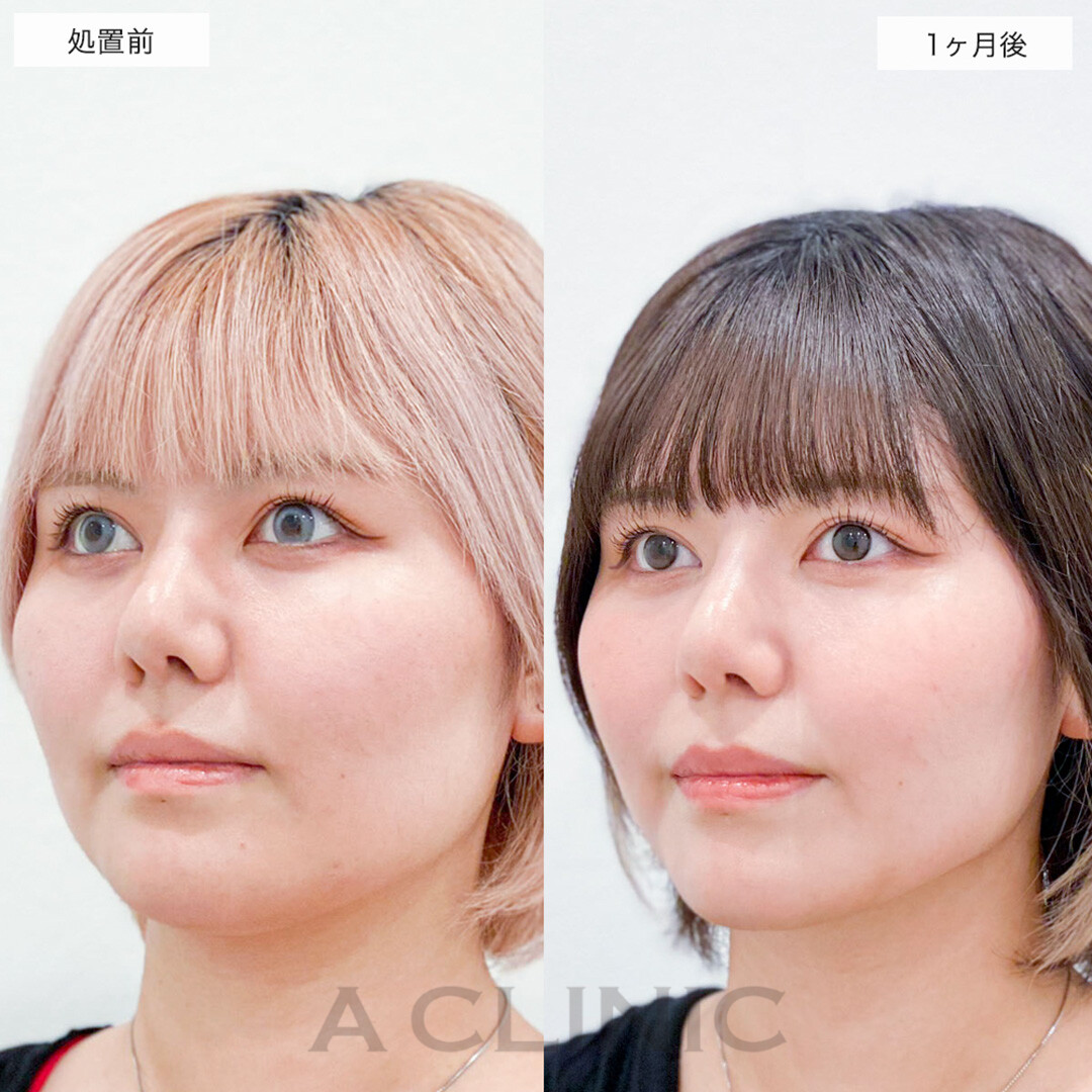 症例写真
