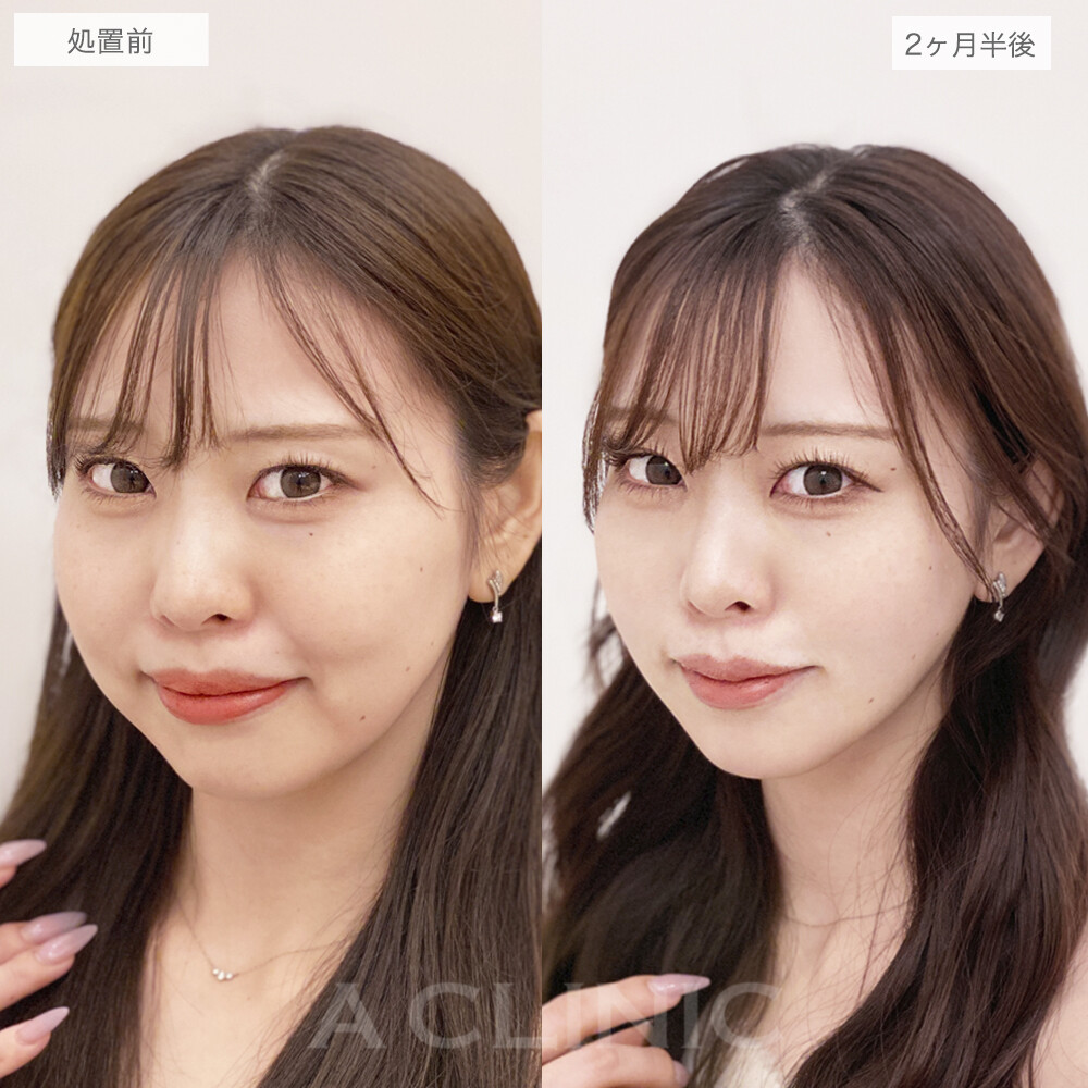 症例写真