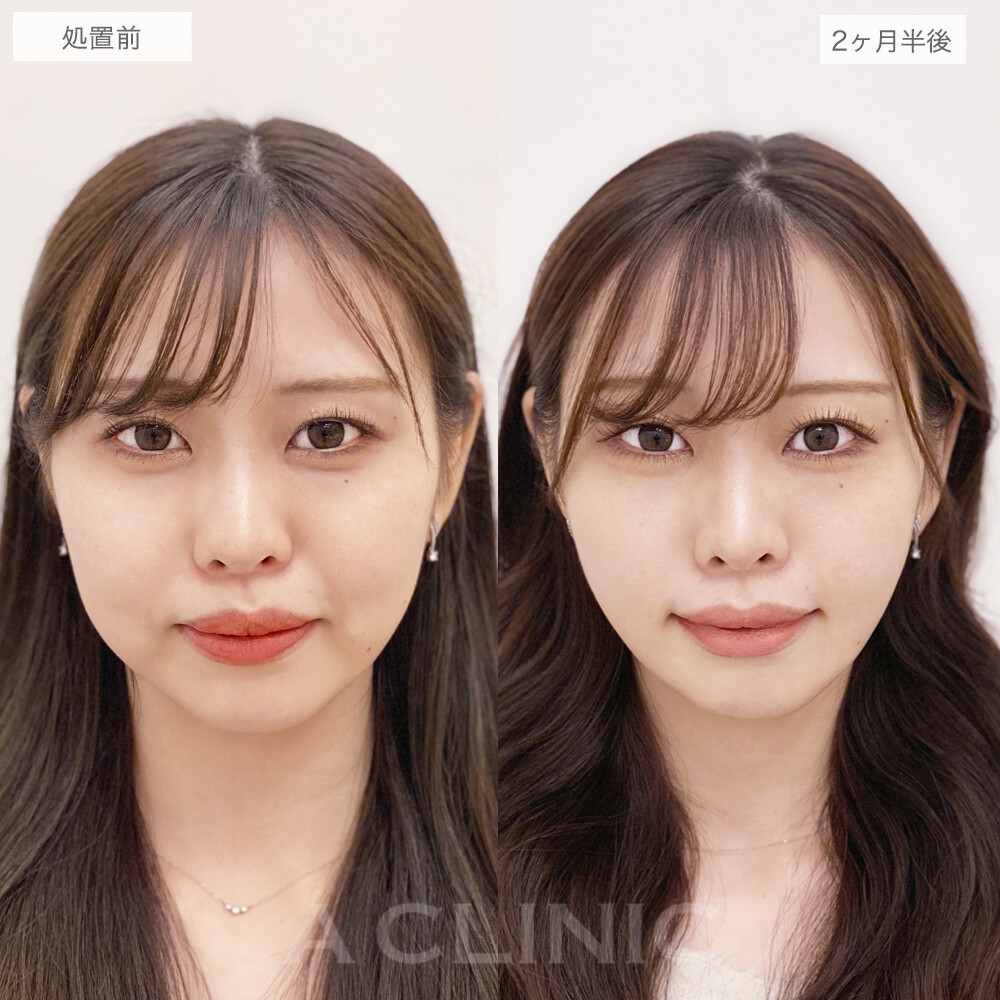 症例写真