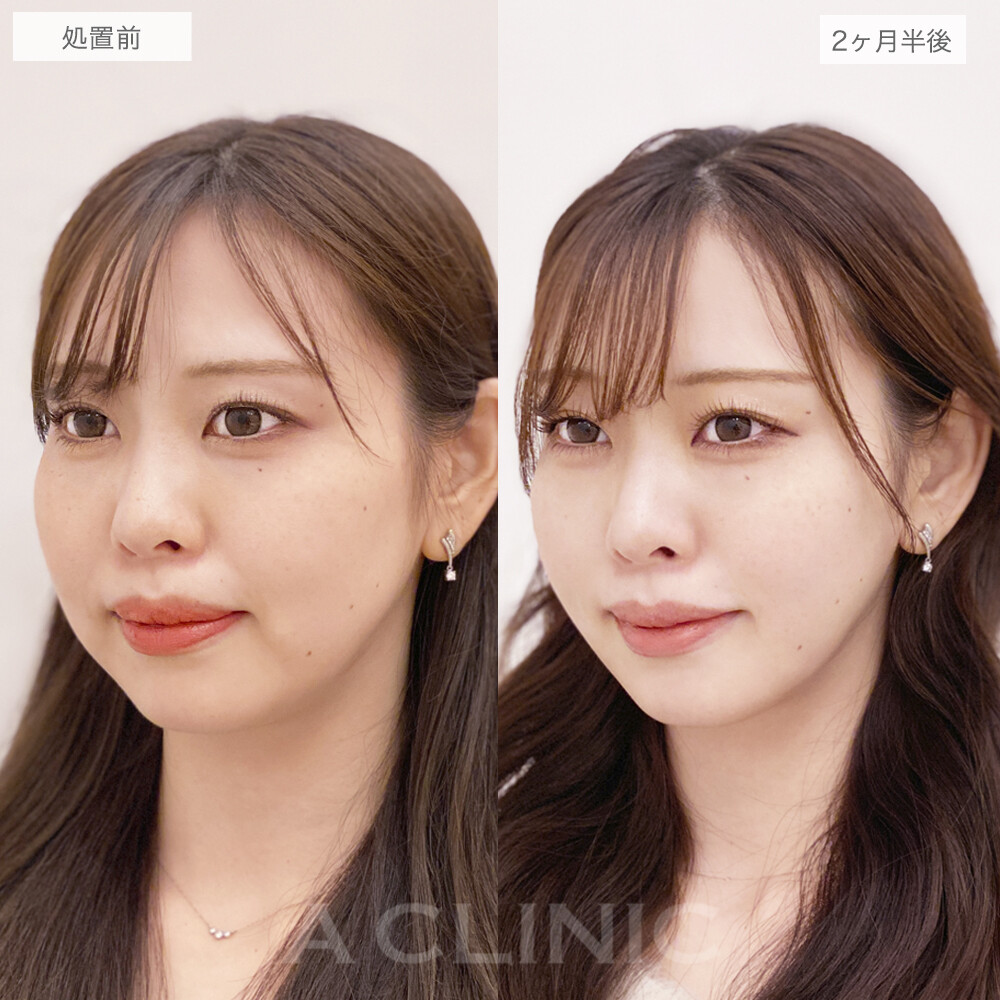 症例写真