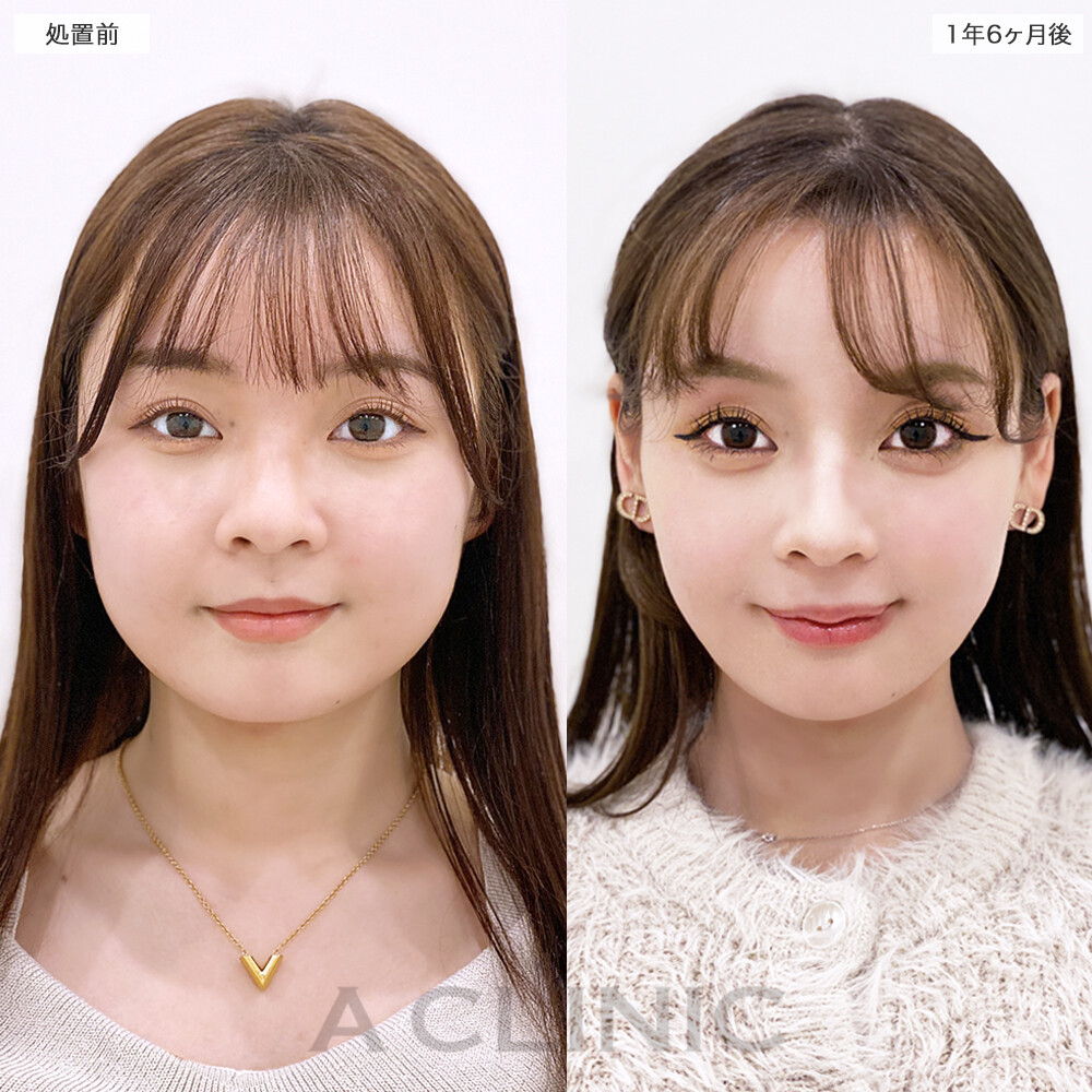 症例写真