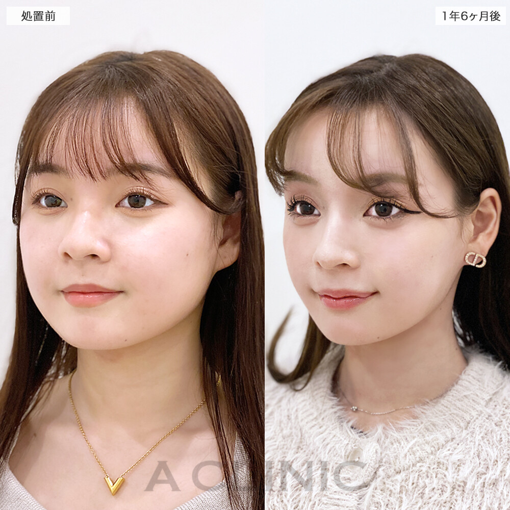 症例写真