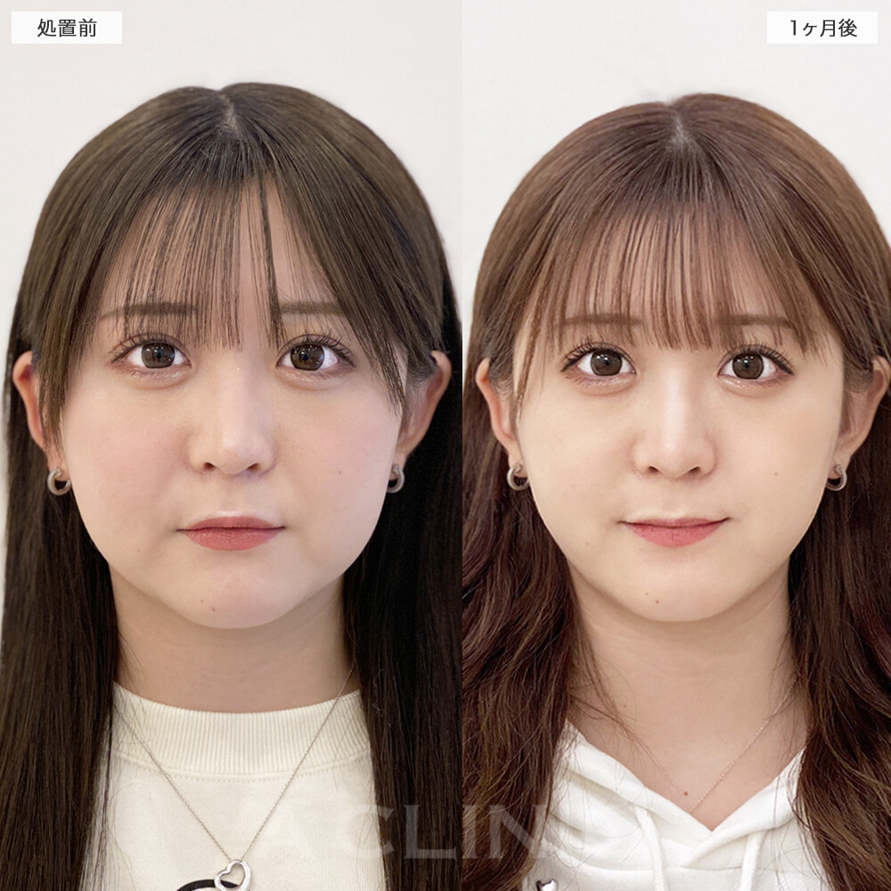症例写真