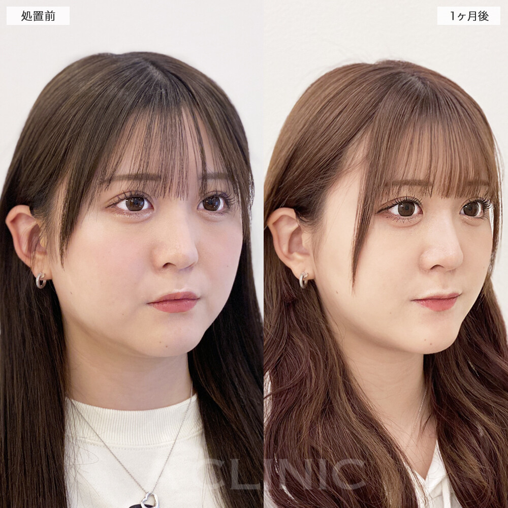 症例写真