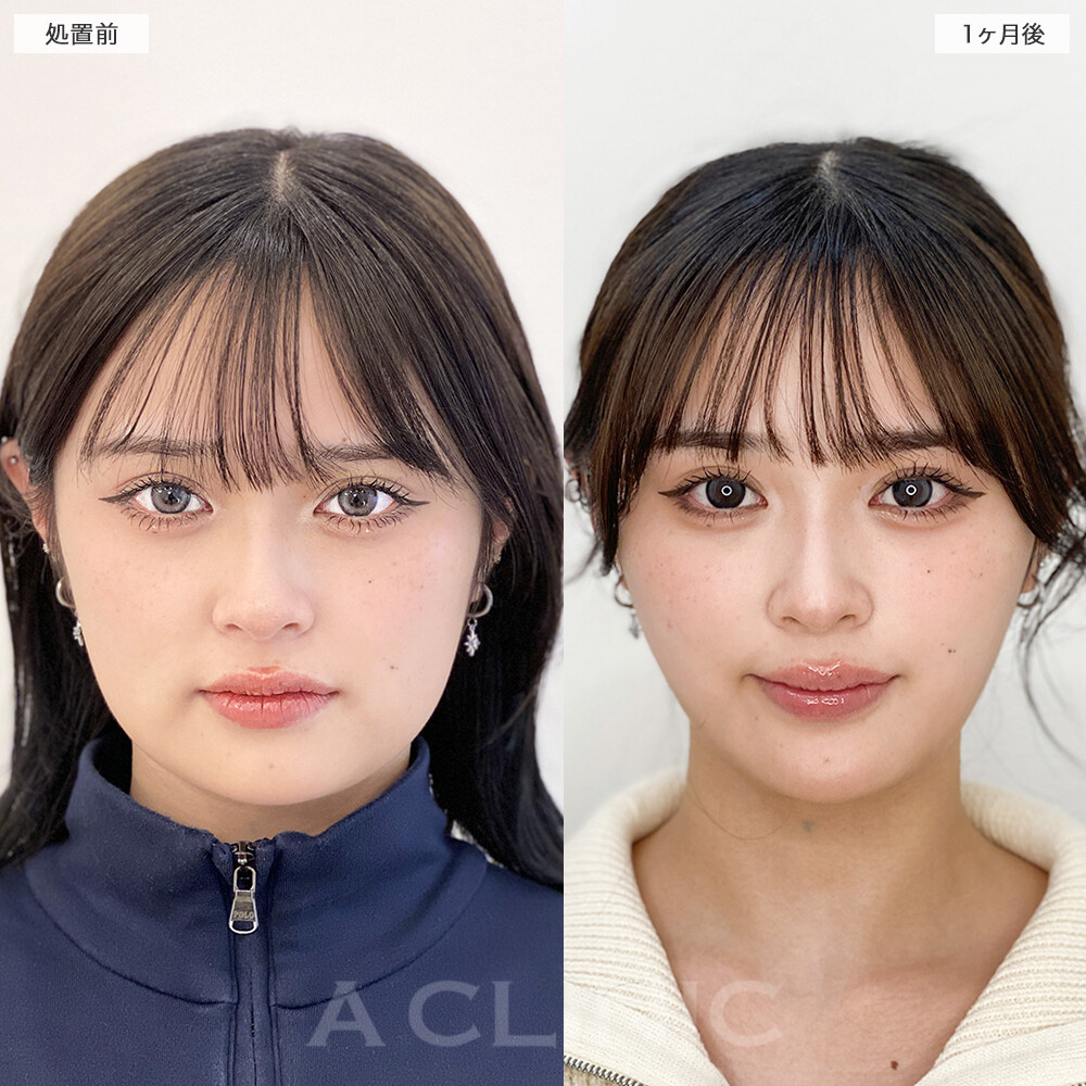 症例写真