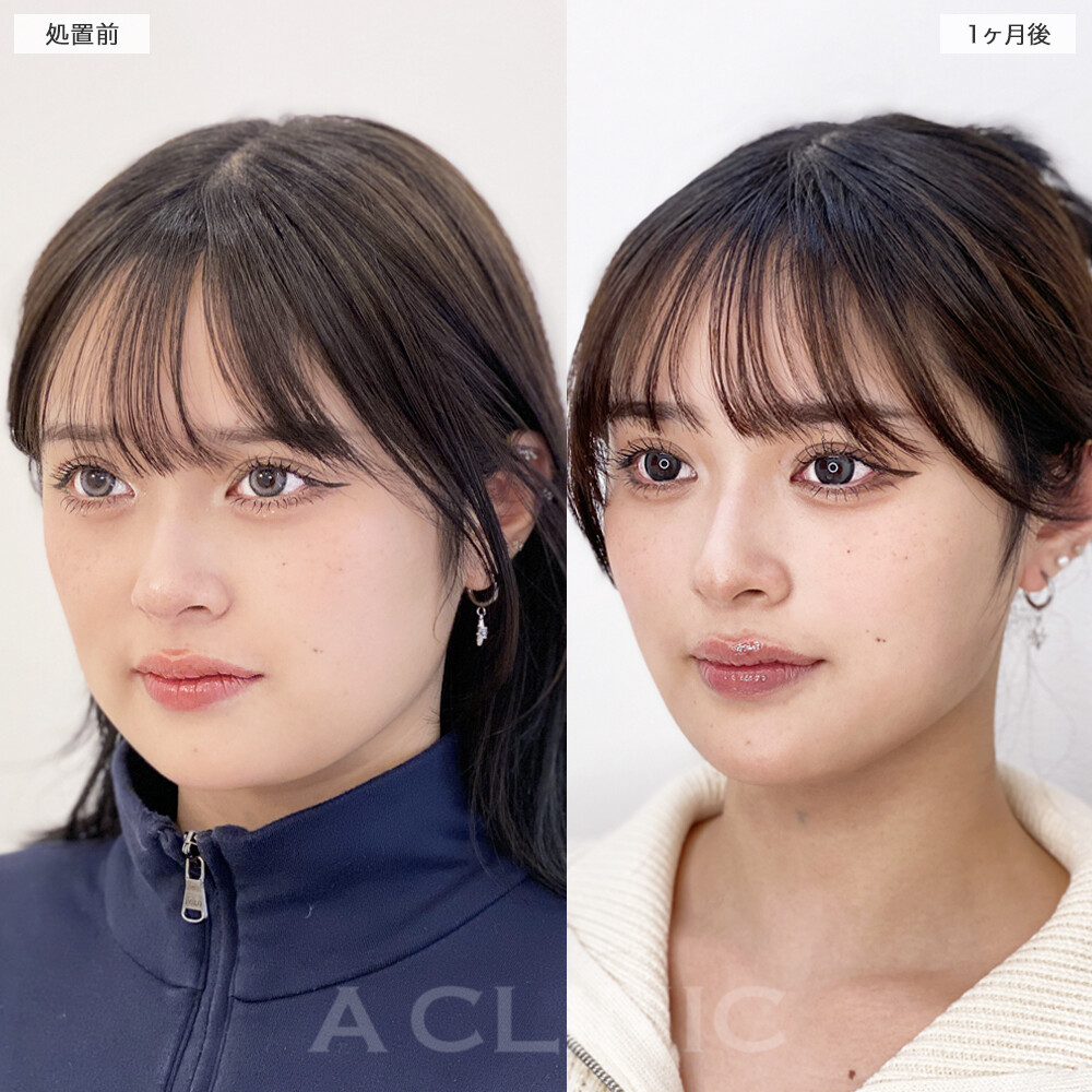 症例写真