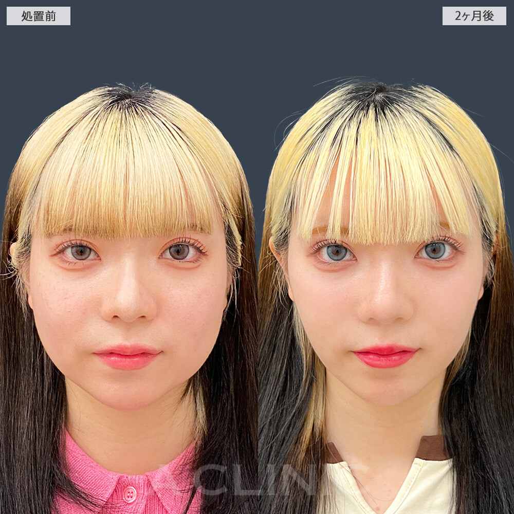 症例写真