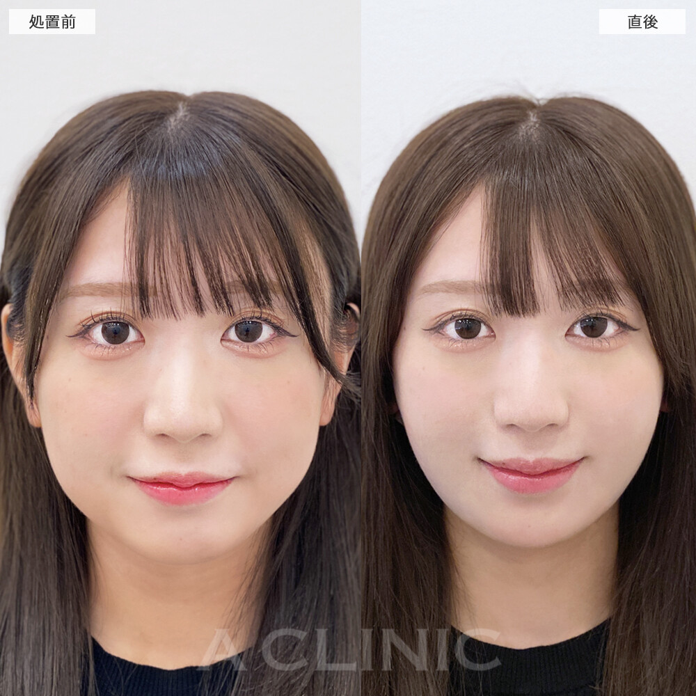 症例写真