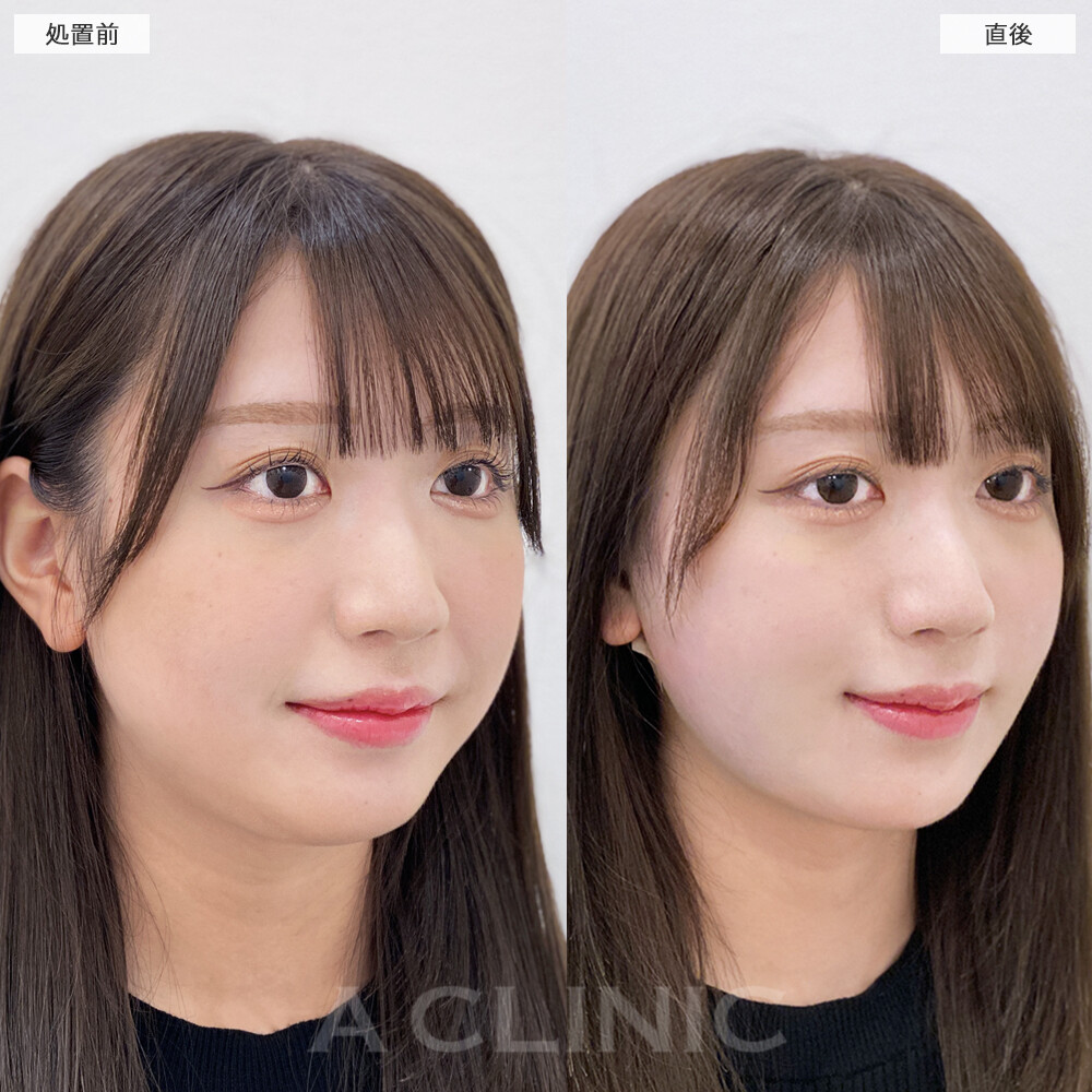 症例写真
