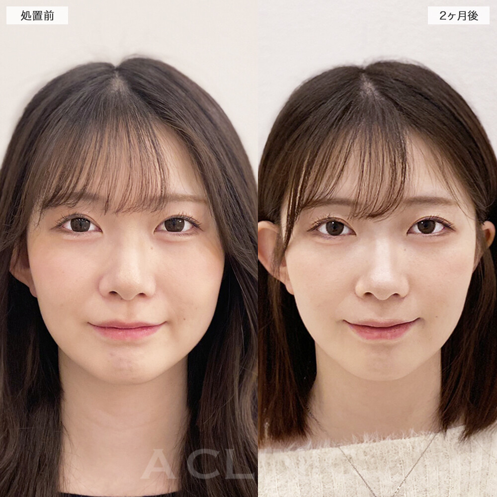 症例写真
