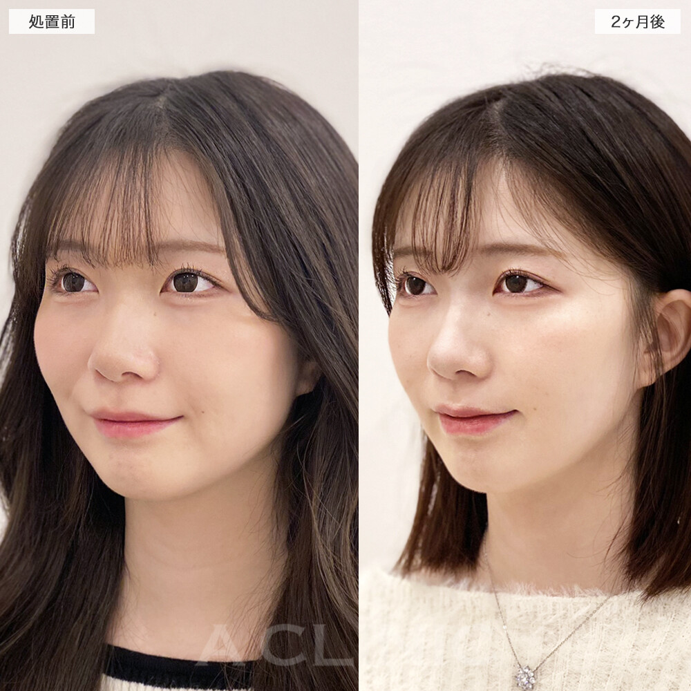 症例写真