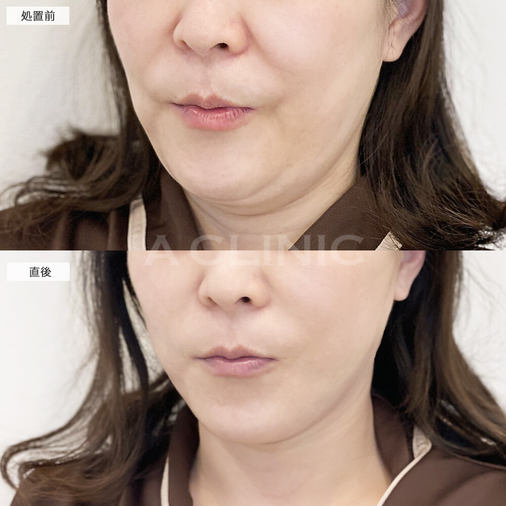 症例写真