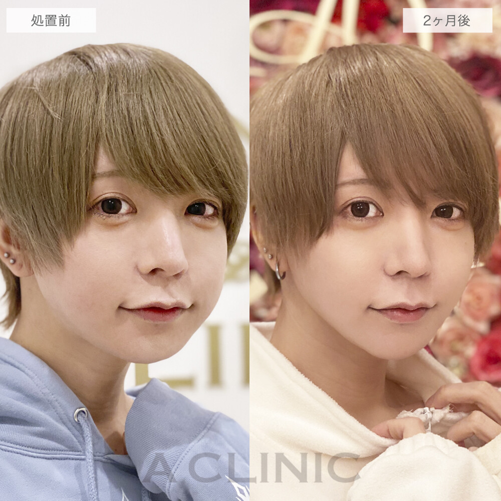 症例写真