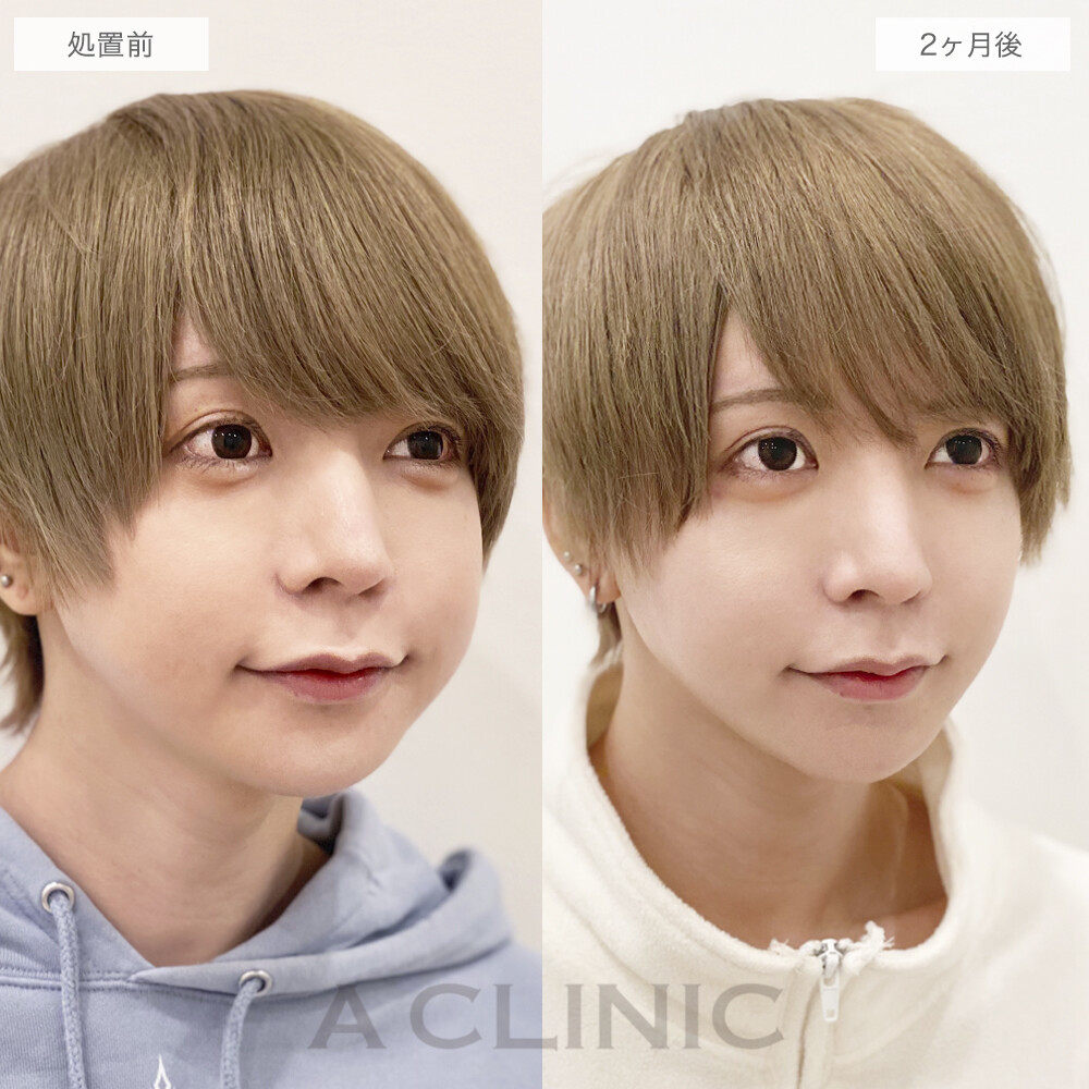 症例写真