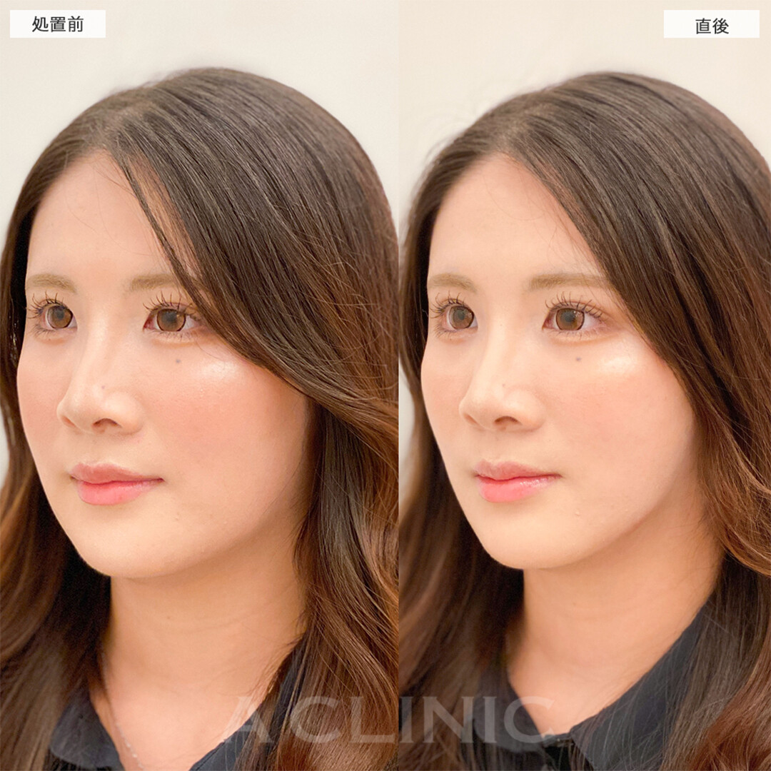 症例写真