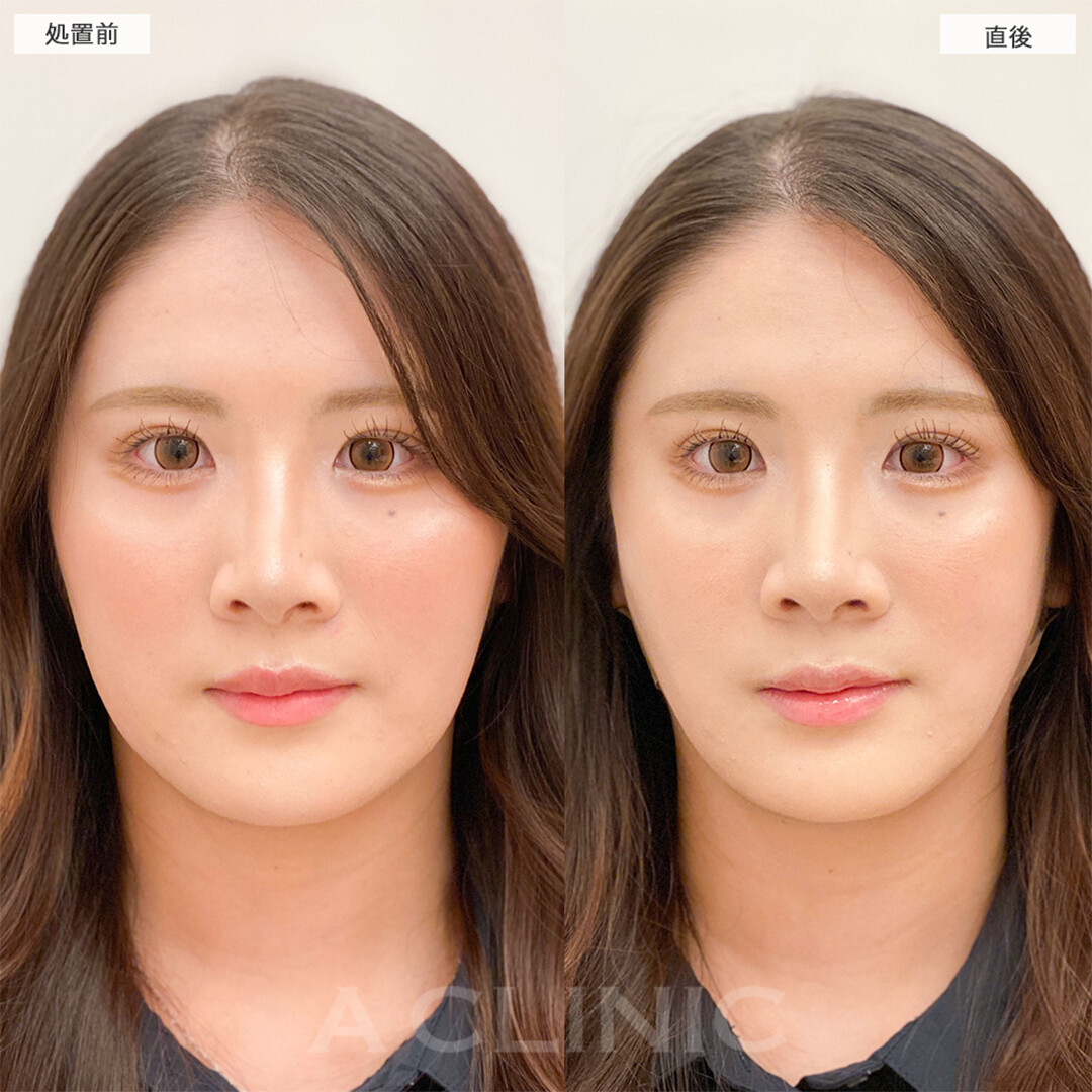 症例写真