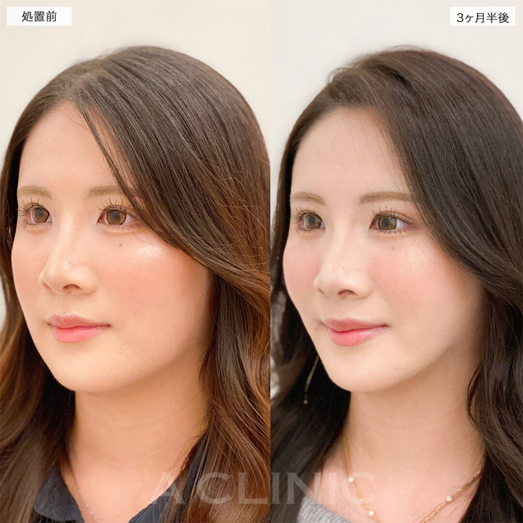 症例写真