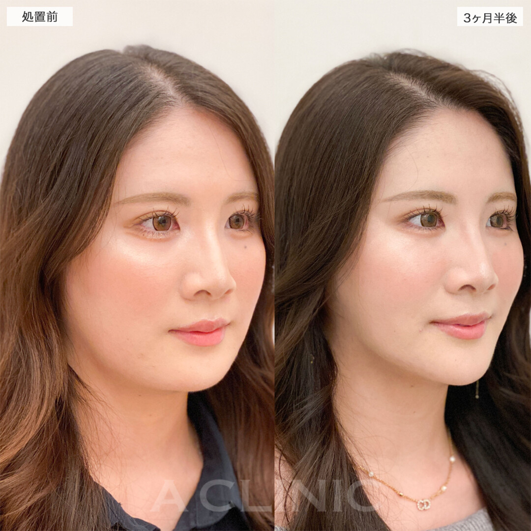 症例写真
