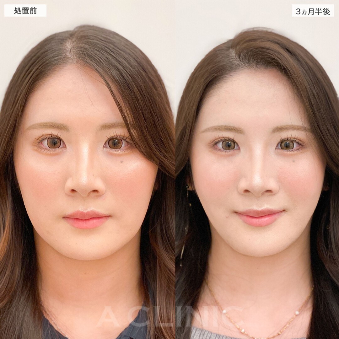 症例写真