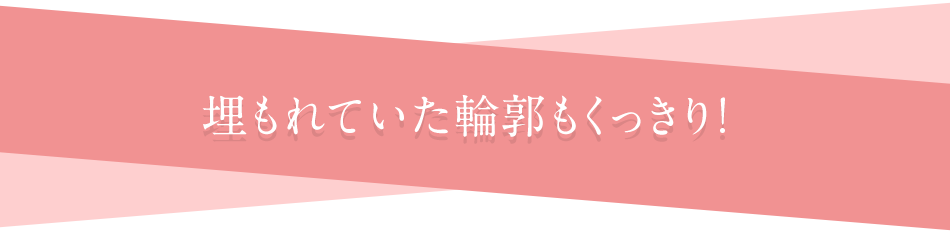 症例写真