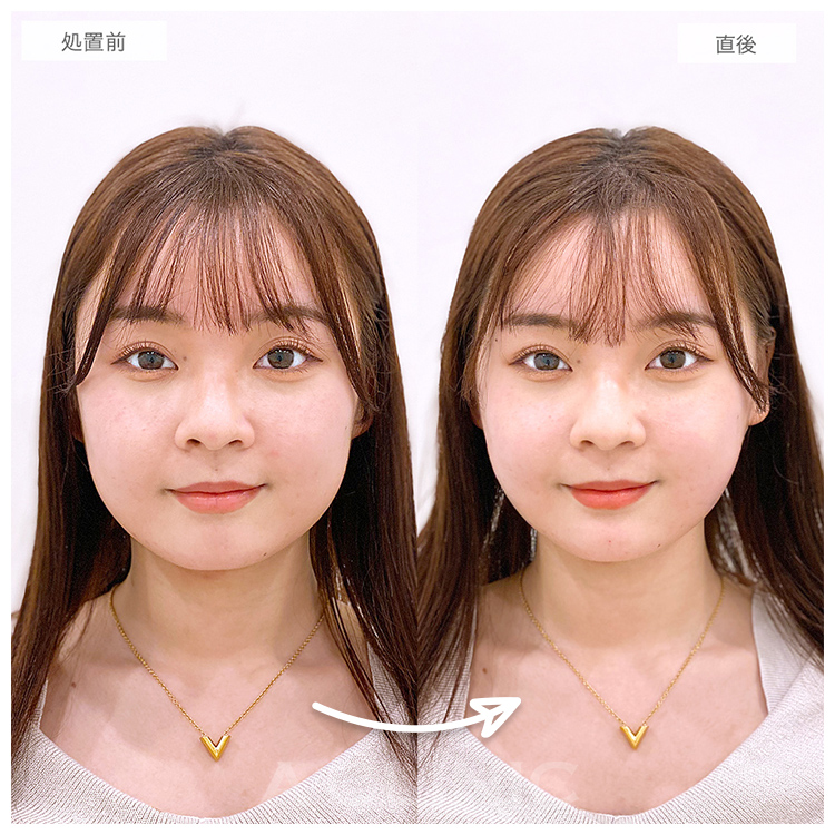 直後の症例写真