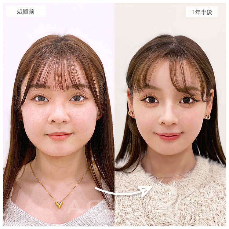 1年後の症例写真
