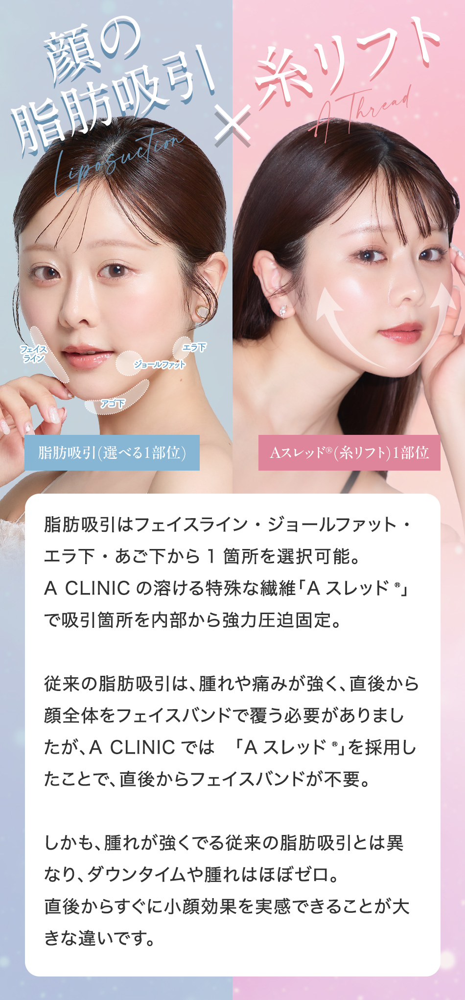 顔の脂肪吸引×糸リフト