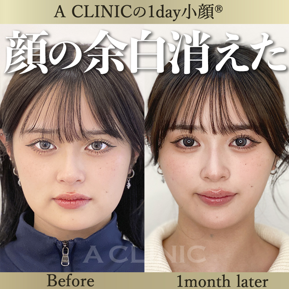 症例写真