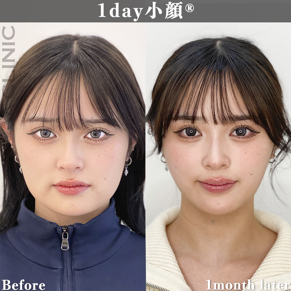 症例写真