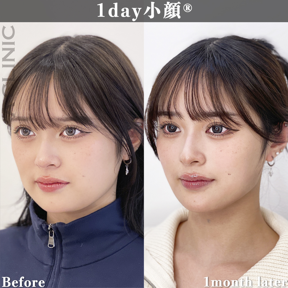 症例写真