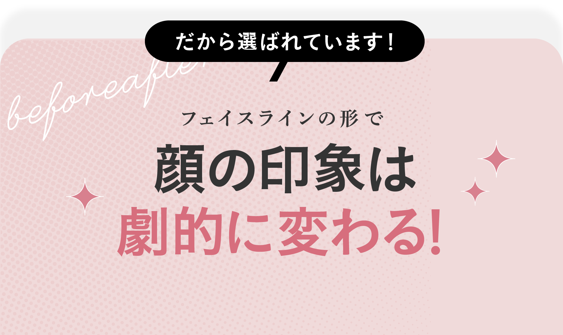 フェイスラインの形で顔の印象は劇的に変わる！だから選ばれています！