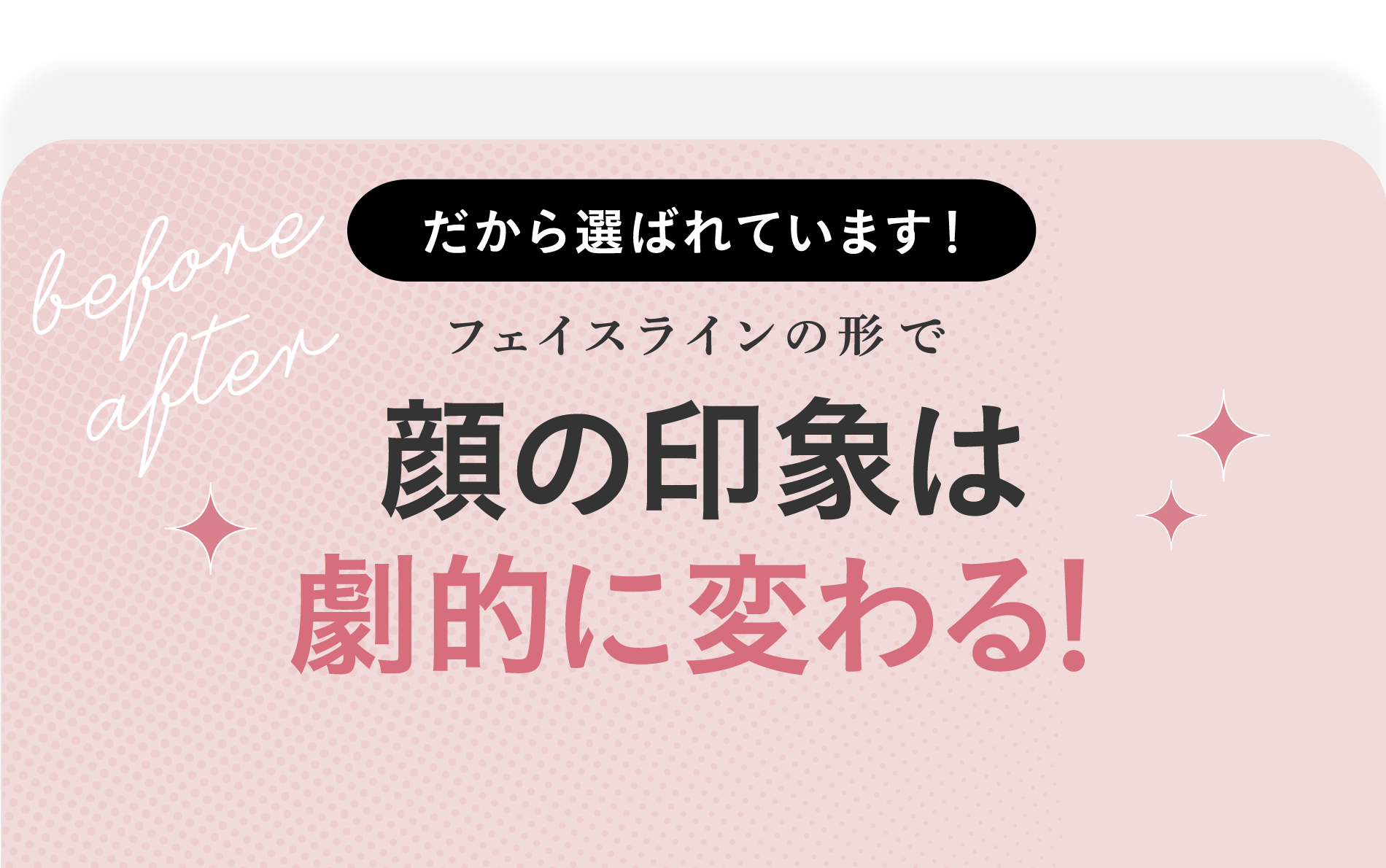 フェイスラインの形で顔の印象は劇的に変わる！だから選ばれています！