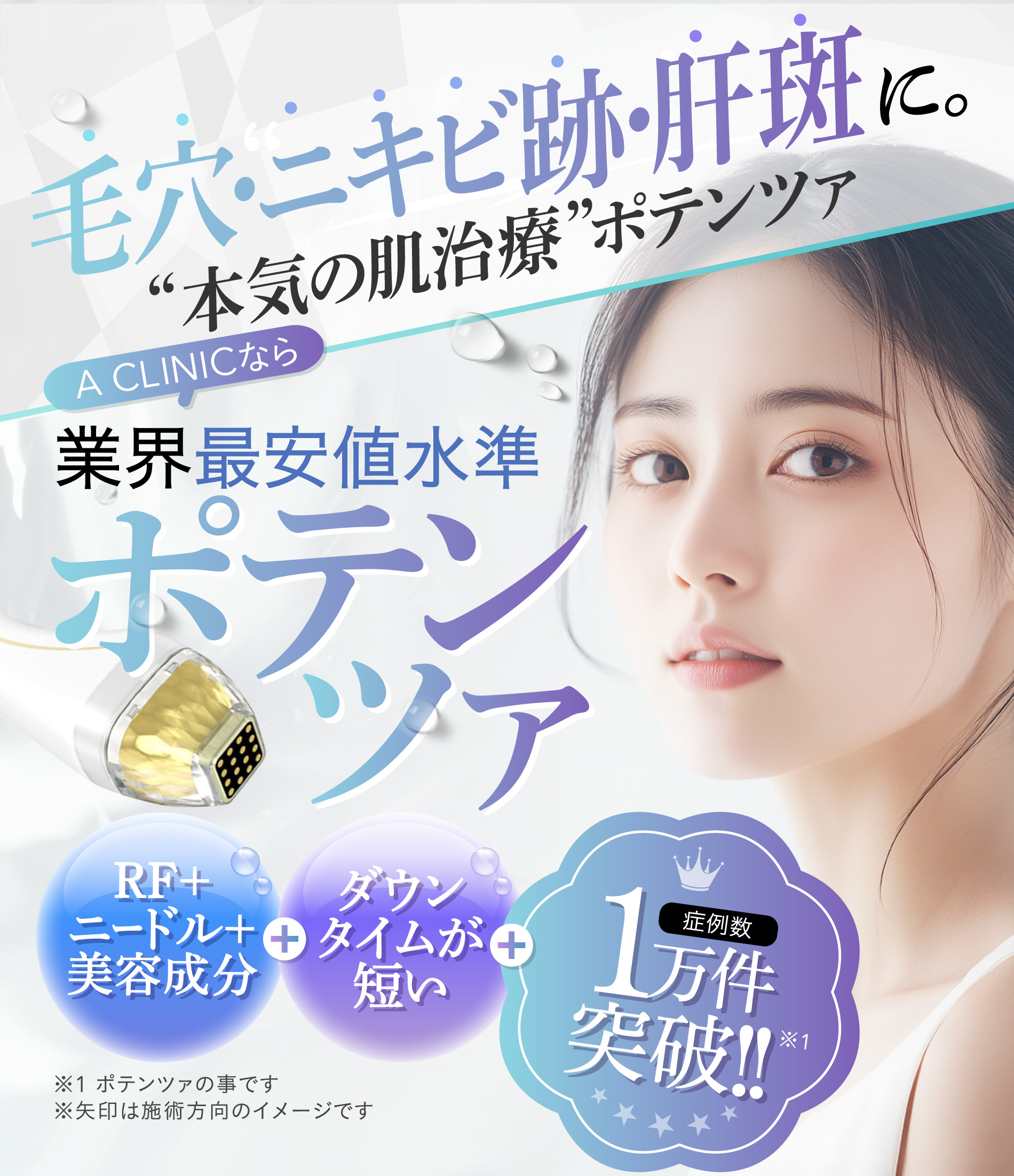 毛穴・ニキビ跡・肝斑に。“本気の肌治療”ポテンツァ A CLINICなら業界最安値水準 ポテンツァ ポテンツァ マックーム x ジュベルック