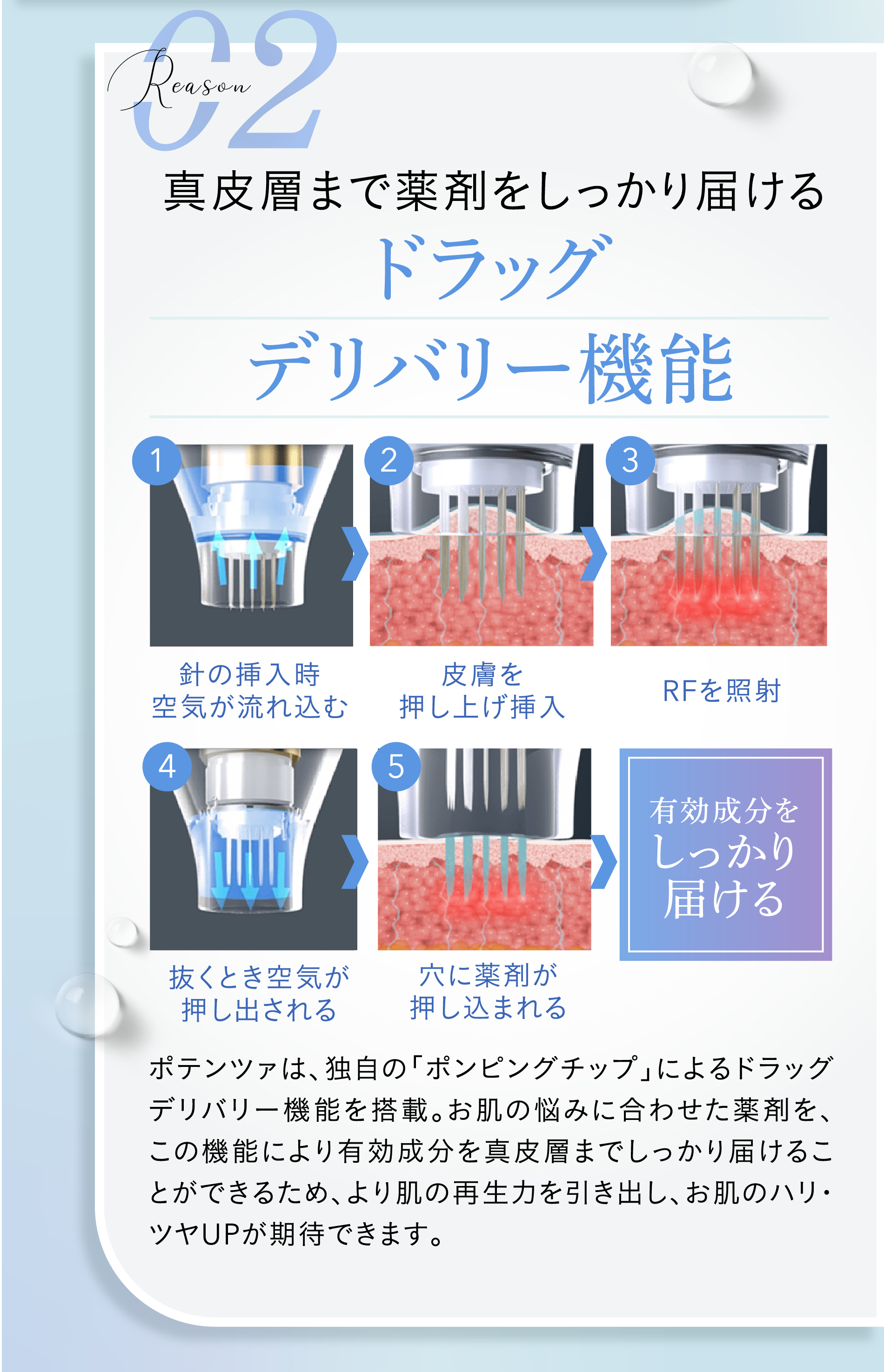 
							reason02 真皮層まで薬剤をしっかり届けるドラッグデリバリー機能
							1.針の挿入時空気が流れ込む
							2.皮膚を押し上げ挿入
							3.RFを照射
							4.抜くとき空気が押し出される
							5.穴に薬剤が押し込まれる
							有効成分をしっかり届ける
							ポテンツァは、独自の「ポンピングチップ」によるドラッグデリバリー機能を搭載。お肌の悩みに合わせた薬剤を、この機能により有効成分を真皮層までしっかり届けることができるため、より肌の再生力を引き出し、お肌のハリ・ツヤUPが期待できます。