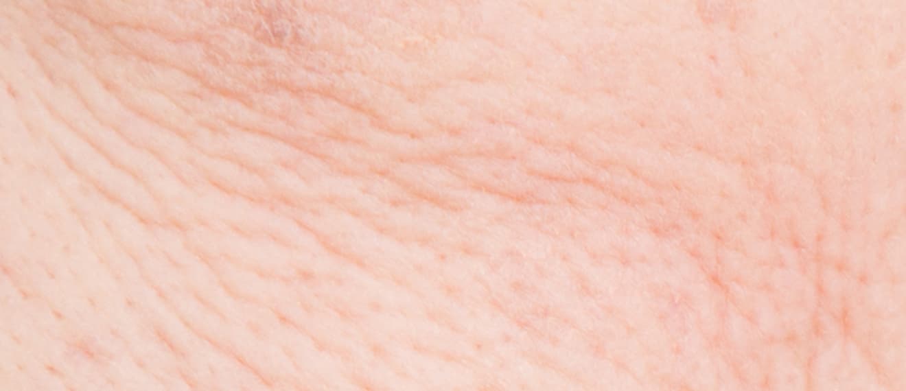 ポテンツァのお肌の再生治療に効果が期待できる肌の写真