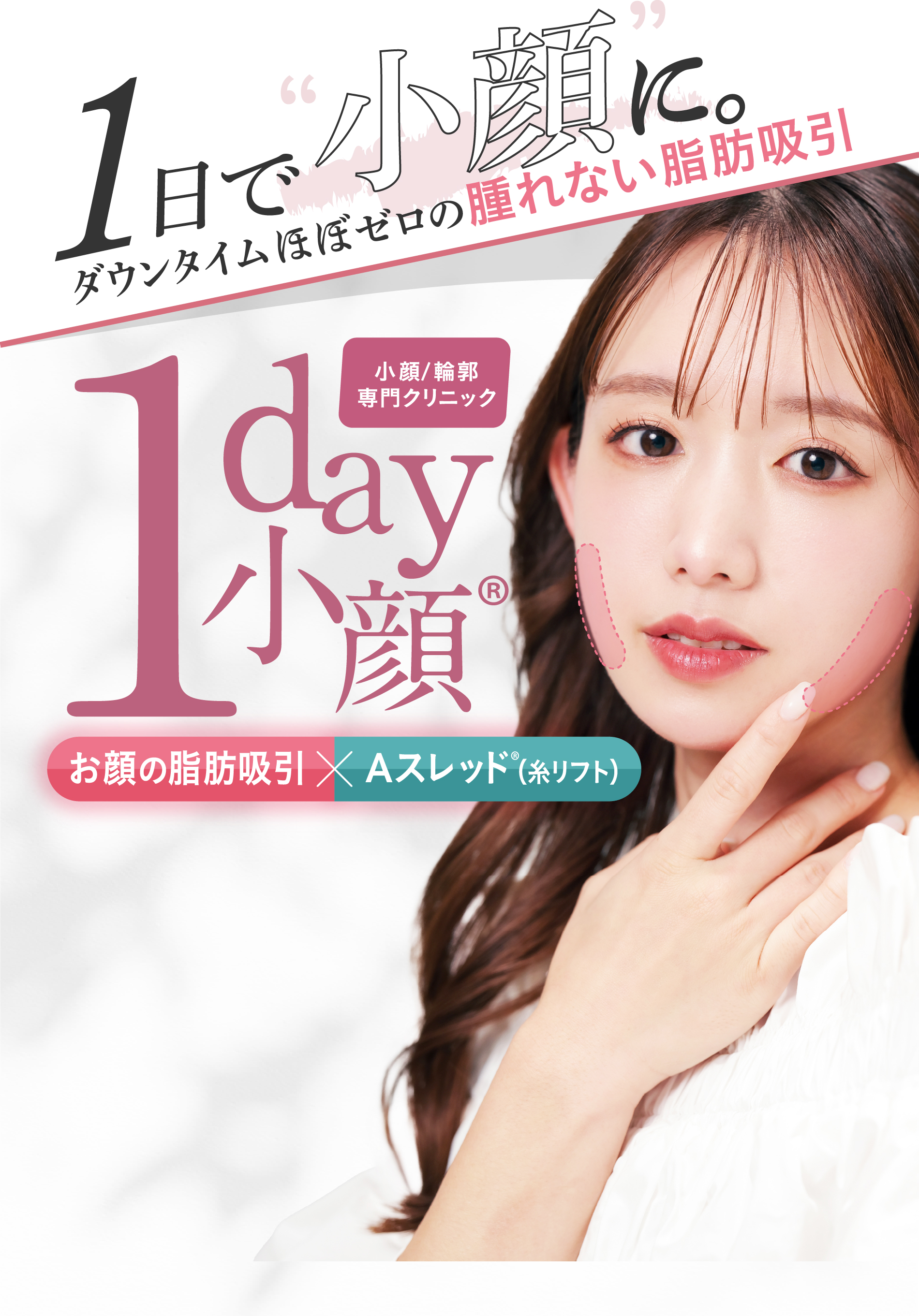 1日で小顔にダウンタイムほぼゼロの腫れない脂肪吸引 | 小顔/輪郭専門クリニック | お顔の脂肪吸引・Aスレッド®︎（糸リフト）