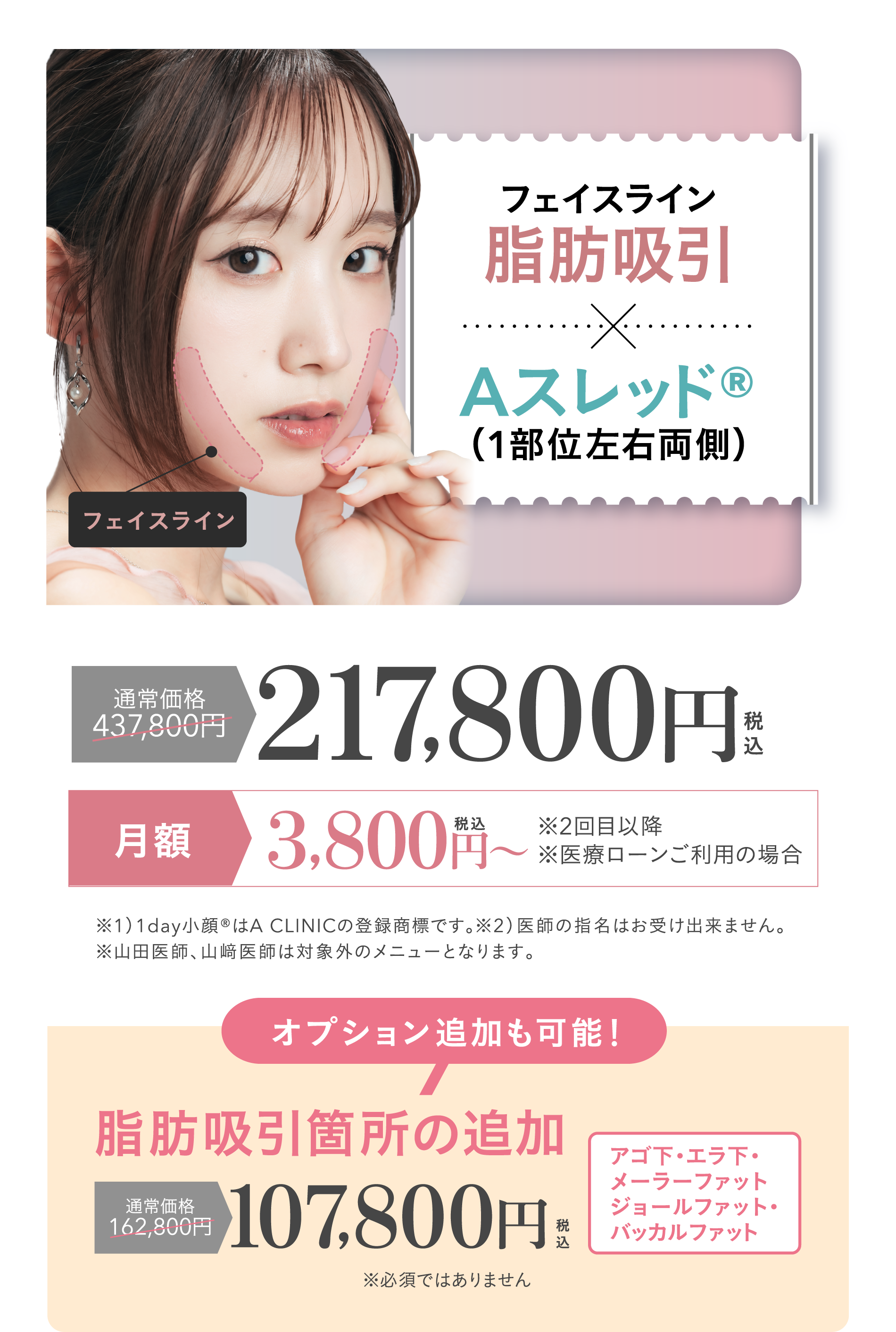 フェイスライン脂肪吸引+Aスレッド®（1部位左右両側）|通常価格437,800円→217,800円（税込） 月額3,800円（税込）～ ※2回目以降 ※医療ローンご利用の場合 | ※1）1day小顔®はA CLINICの登録商標です。 ※医師の指名はお受け出来ません。 山田医師、山﨑医師は対象外のメニューとなります。| オプション追加も可能！脂肪吸引箇所の追加 通常価格162,800円が107,800円（税込） ※必須ではありません| アゴ下・エラ下・メーラーファット・ジョールファット・バッカルファット