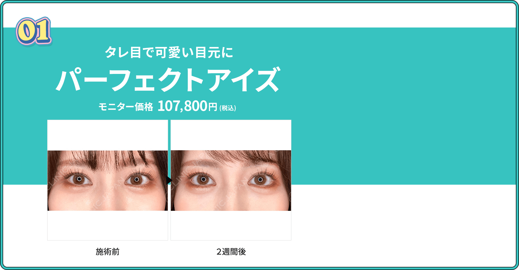 01 タレ目で可愛い目元に パーフェクトアイズ