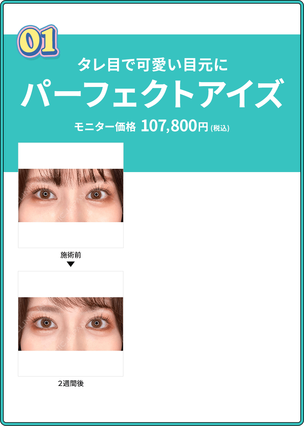 01 タレ目で可愛い目元に パーフェクトアイズ