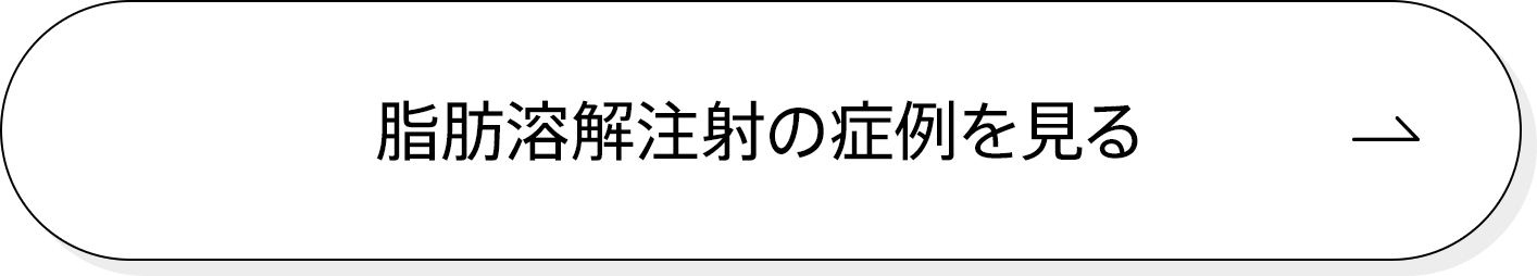 脂肪溶解注射の症例を見る