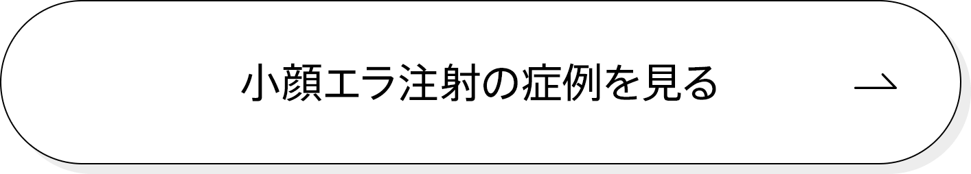 小顔エラ注射の症例を見る