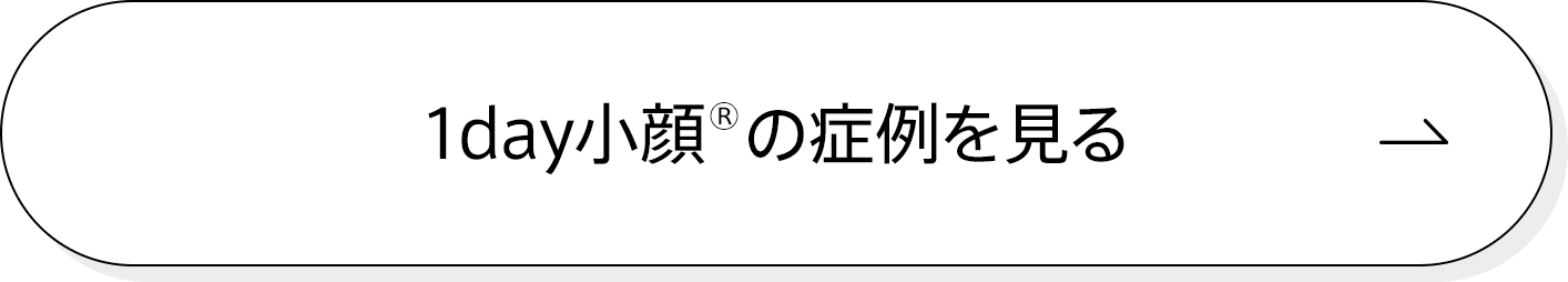 1day小顔®の症例を見る