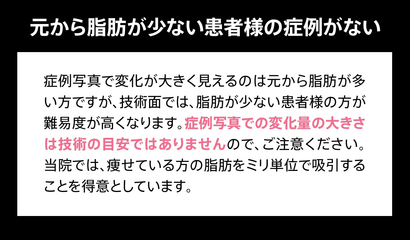 元から脂肪が少ない患者様の症例がない 症例写真で変化が大きく見えるのは元から脂肪が多い方ですが、技術面では、脂肪が少ない患者様の方が難易度が高くなります。症例写真での変化量の大きさは技術の目安ではありませんので、ご注意ください。当院では、痩せている方の脂肪をミリ単位で吸引することを得意としています。