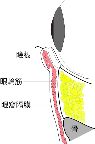 目の下のふくらみ取り施術の流れ