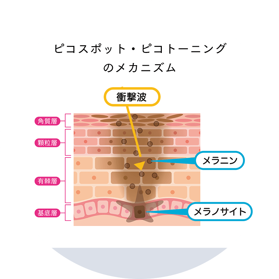 ピコスポット・ピコトーニングのメカニズム