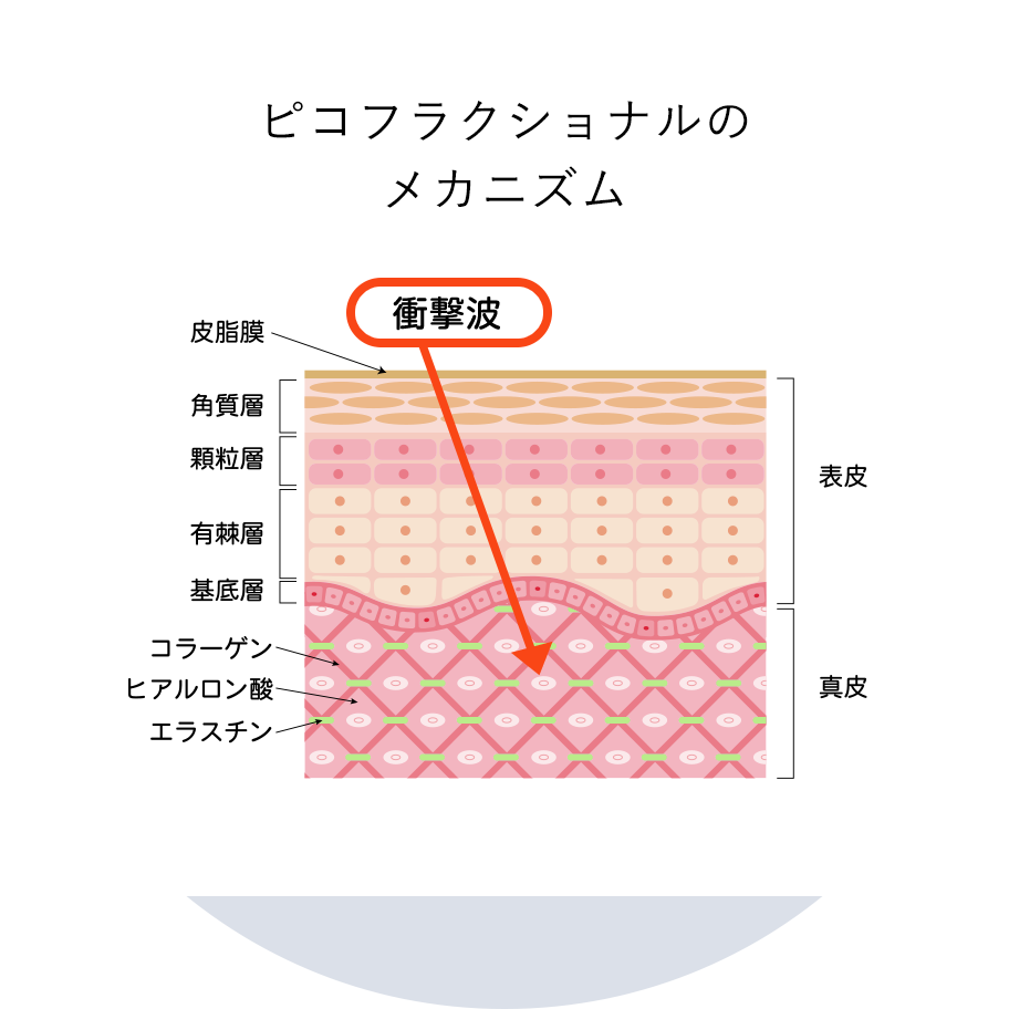 ピコフラクショナルのメカニズム